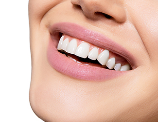 kosmetische Zahnaufhellung, lachendes Gesicht mit weißen Zähnen